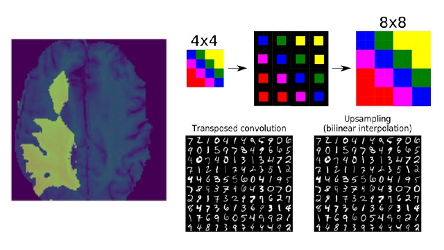 Biomedical Image Segmentation With U Net Intel Ai