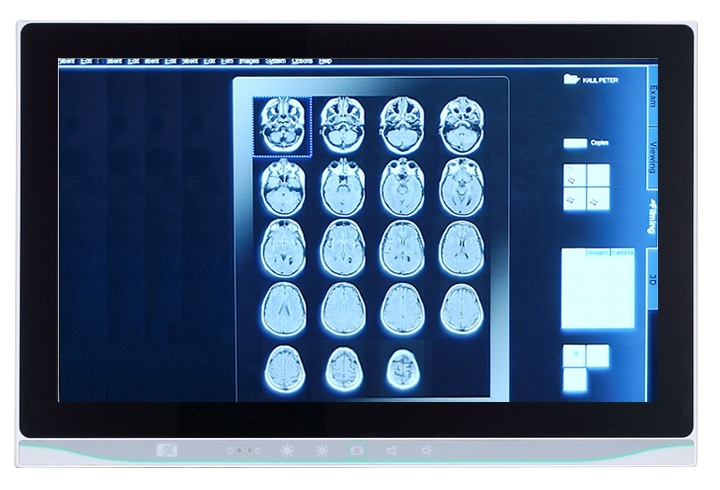 Axiomtek’s MPC153-834 medical panel PC is specifically designed for the medical environment with an IPX1-compliant chassis and an IP65/NEMA 4-rated spill- and dust-resistant front panel.